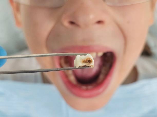 Best Emergency Dentist for Knocked-Out Tooth in Trinity, NC