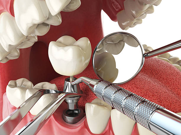 Best Broken or Cracked Tooth Emergency Dentist in Trinity, NC